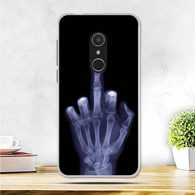For Alcatel 1X Case Alcatel 1X Case Cover Luxury Soft Silicone Phone Case For Alcatel 1X 5059D 5059 5059A 1 X Case Back Cover